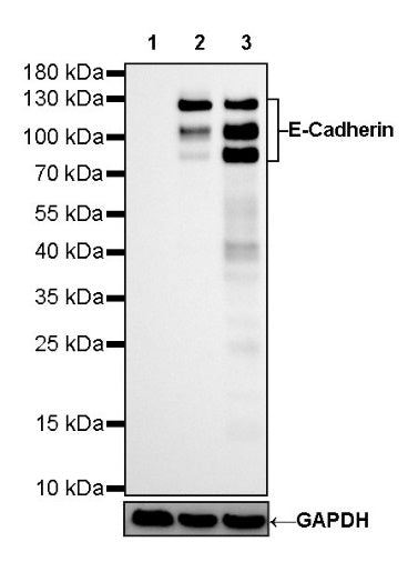 S-RMab® E-Cadherin Recombinant Rabbit mAb (SDT-438-5)