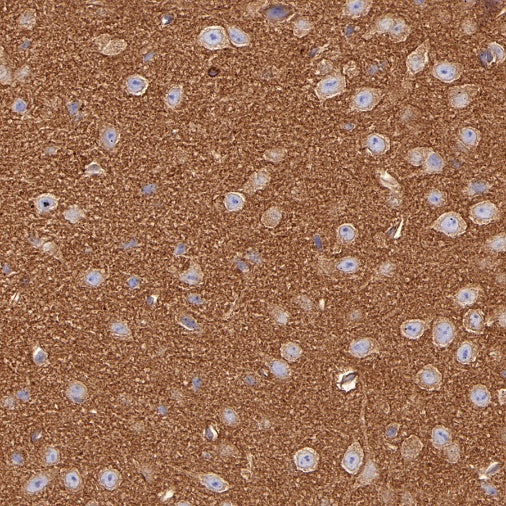 Non-muscle Myosin IIB/MYH10 Recombinant Rabbit mAb (S-299-3)