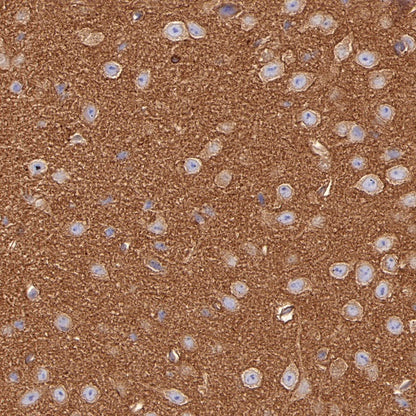 Non-muscle Myosin IIB/MYH10 Recombinant Rabbit mAb (S-299-3)