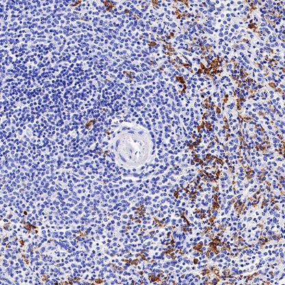 CD163 Recombinant Rabbit mAb (SDT-222-171)