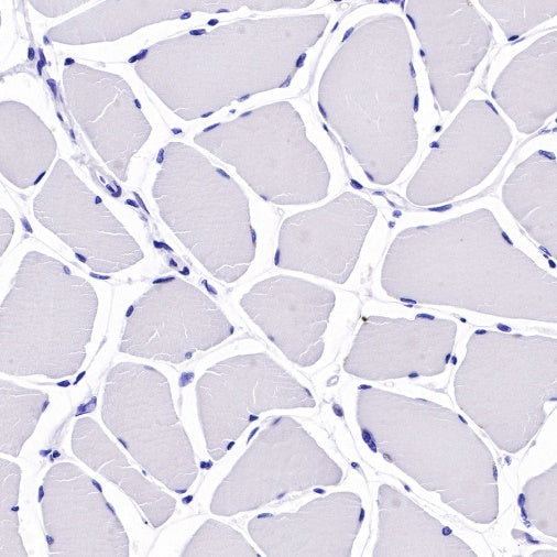 Bcl-xL Recombinant Rabbit mAb (S-487-28)