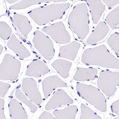 Bcl-xL Recombinant Rabbit mAb (S-487-28)