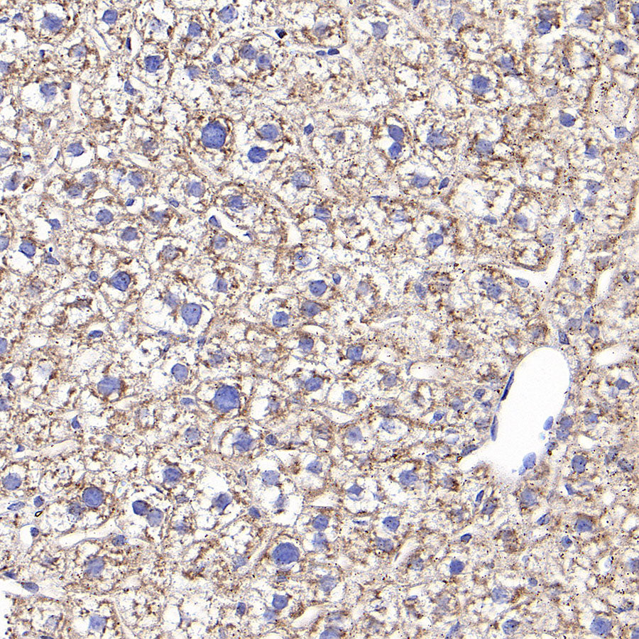 RPLP0 Rabbit Polyclonal Antibody