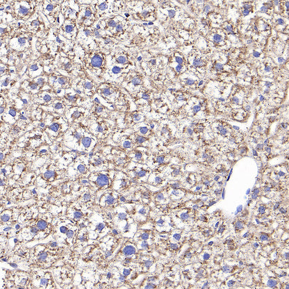 RPLP0 Rabbit Polyclonal Antibody