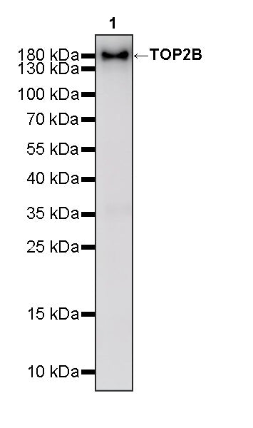 TOP2B Recombinant Rabbit mAb (S-4452-44)