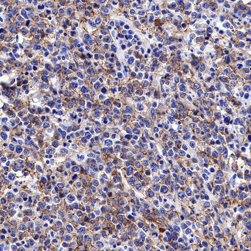 CD20 Recombinant Rabbit mAb (SDT-038-205)