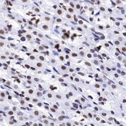 CREB Recombinant Rabbit mAb (S-1115-39)