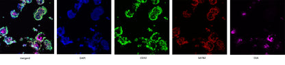 Noggin Protein, Human