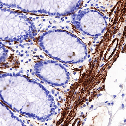 Myosin-11/SMMHC Recombinant Rabbit mAb,PBS Only (SDT-188-112)