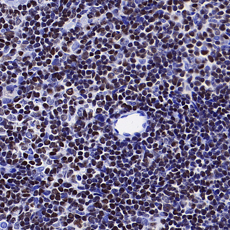 IKZF1 Recombinant Rabbit mAb (S-4176-17)