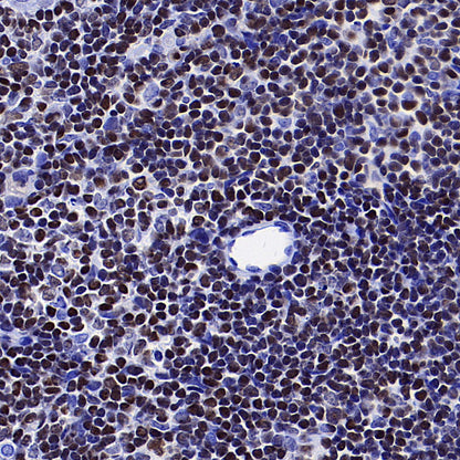 IKZF1 Recombinant Rabbit mAb (S-4176-17)