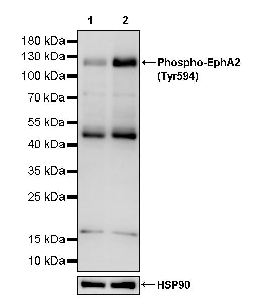 Phospho-EphA2 (Tyr594) Recombinant Rabbit mAb (S-3503-91)