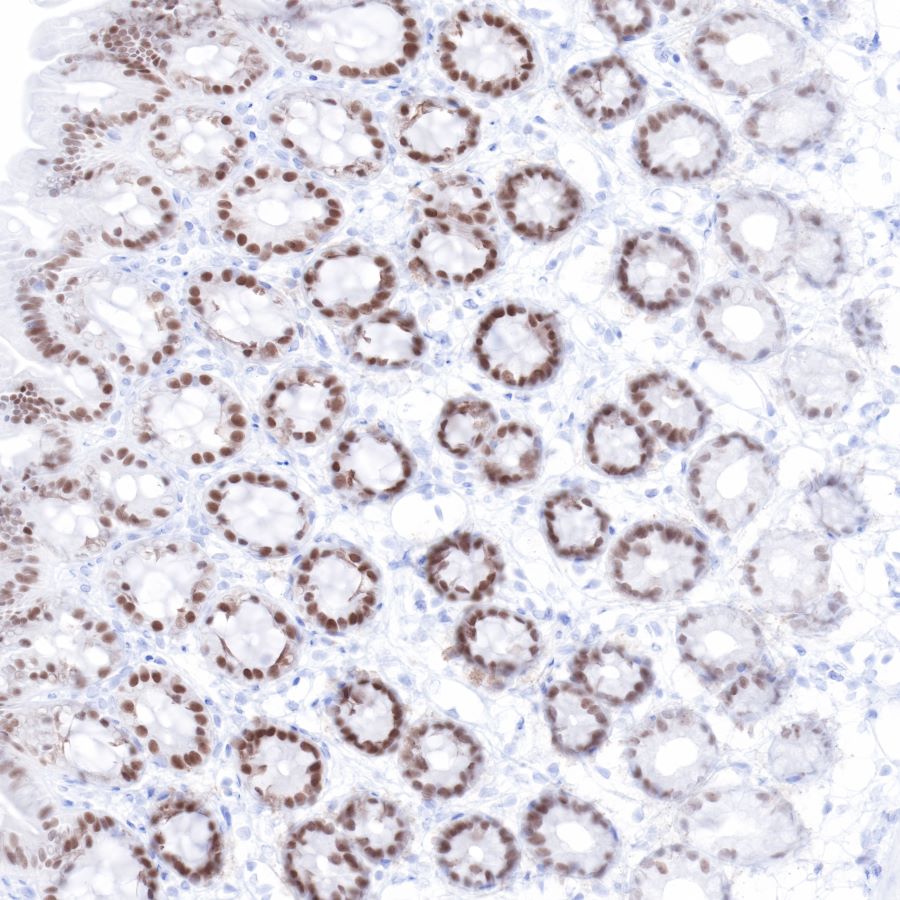 CDX2 Recombinant Rabbit mAb (SDT-134-76)