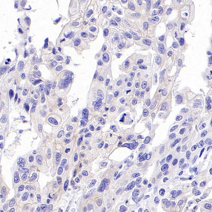 ErbB3 Recombinant Rabbit mAb (SDT-991-14)