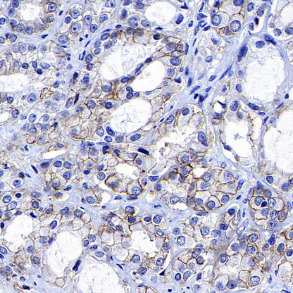 STEAP1+STEAP1B1+STEAP1B2 Recombinant Rabbit mAb (S-3226-137)