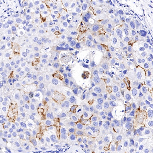 B7-H4 Recombinant Rabbit mAb (SDT-314-447-2)