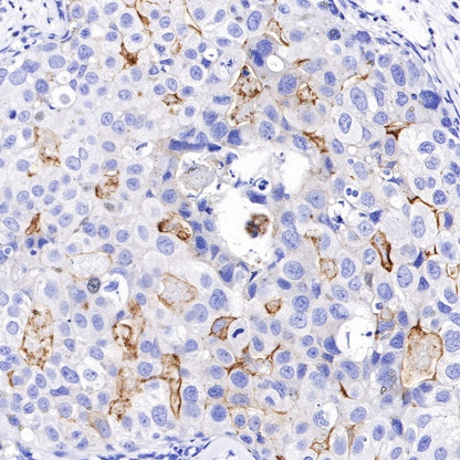 B7-H4 Recombinant Rabbit mAb (SDT-314-447-2)