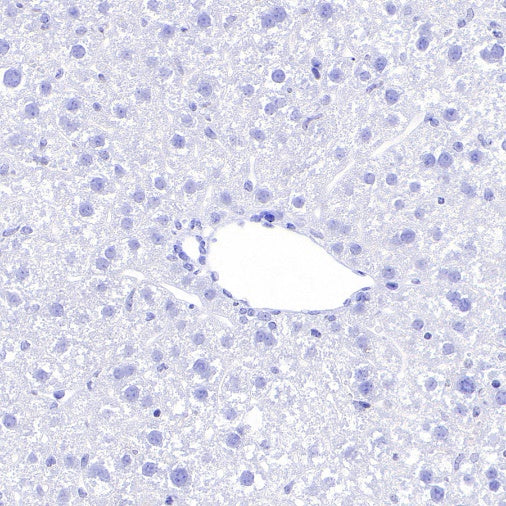 Pan Trk Recombinant Rabbit mAb (SDT-400-39)