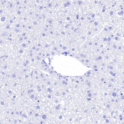 Pan Trk Recombinant Rabbit mAb (SDT-400-39)