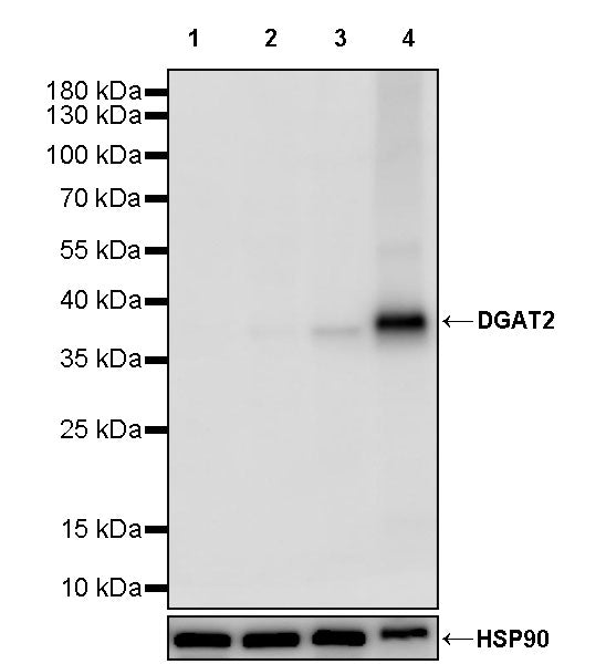 DGAT2 Recombinant Rabbit mAb (S-3871-31)