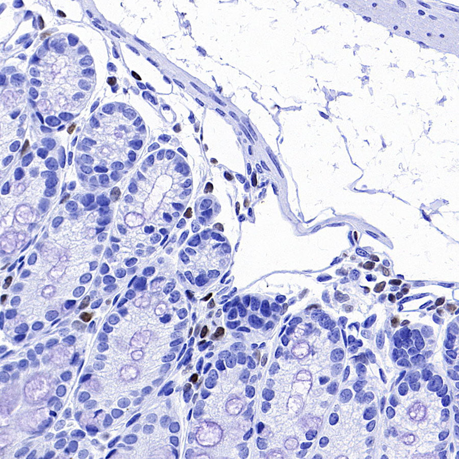 IKZF1 Recombinant Rabbit mAb (S-4176-17)