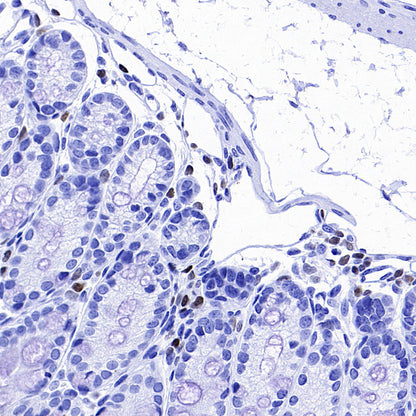 IKZF1 Recombinant Rabbit mAb (S-4176-17)