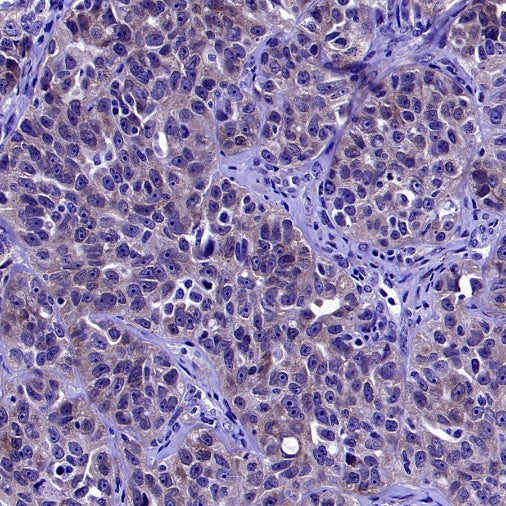 PSAP Recombinant Rabbit mAb (S-2399-11)