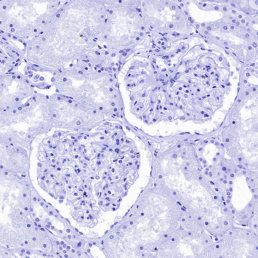 Cytokeratin 1 Recombinant Rabbit mAb (SDT-3225-22)