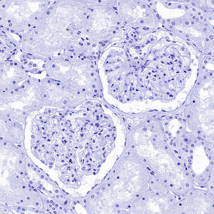 Cytokeratin 1 Recombinant Rabbit mAb (SDT-3225-22)