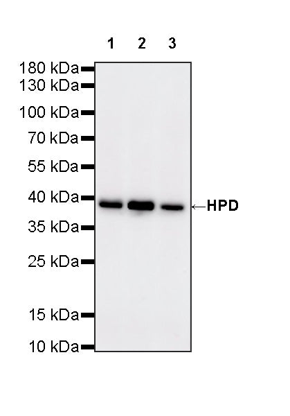 HPD Recombinant Rabbit mAb (S-4536-65)