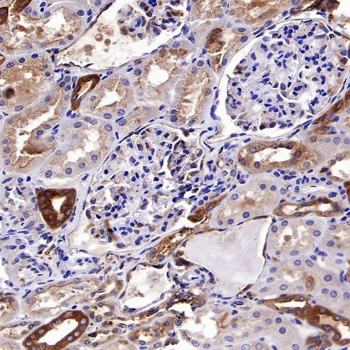 Dynamin 2 Recombinant Rabbit mAb (S-1751-209)