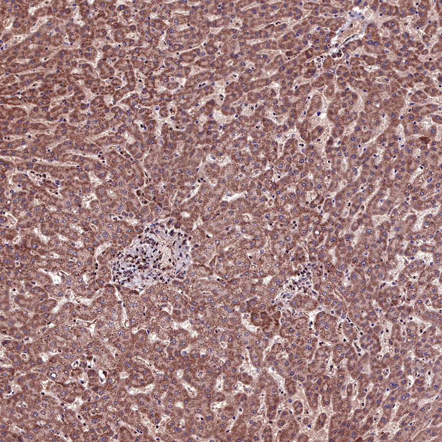 Acetyllysine Recombinant Rabbit mAb (SDT-R096)