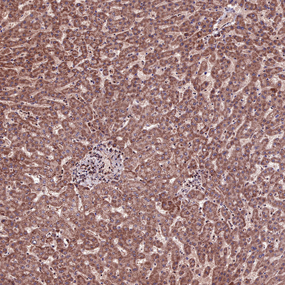 Acetyllysine Recombinant Rabbit mAb (SDT-R096)