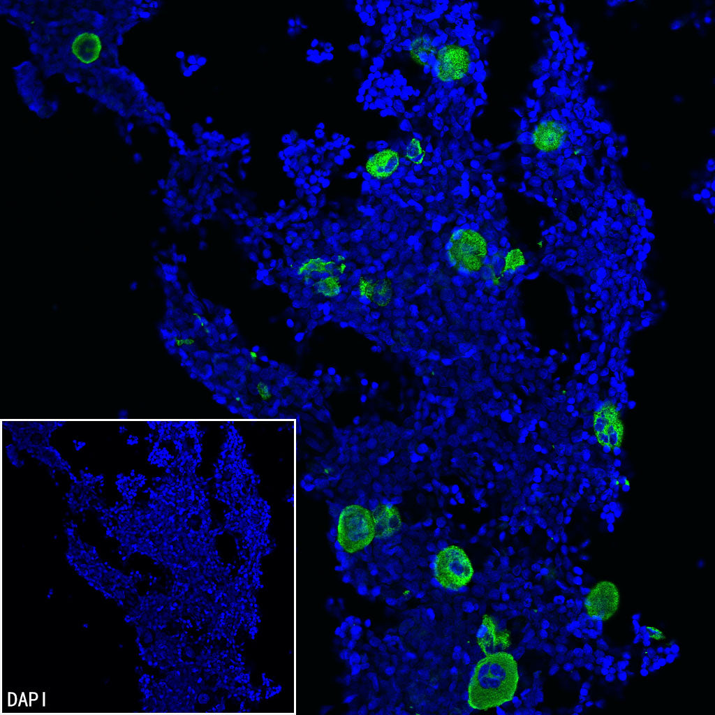 Thrombospondin 1 Recombinant Rabbit mAb (S-4153-22)