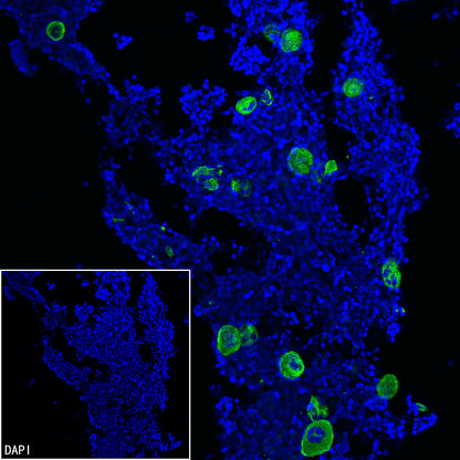Thrombospondin 1 Recombinant Rabbit mAb (S-4153-22)