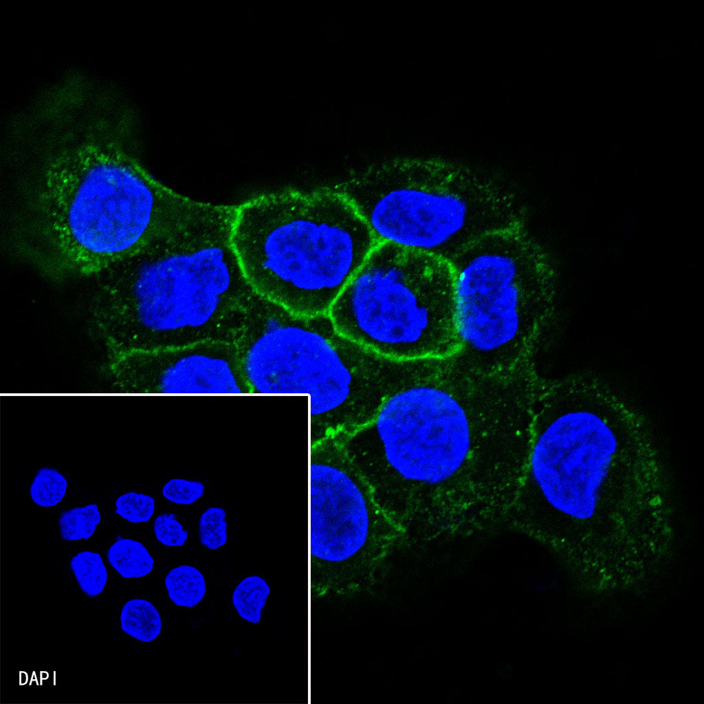 CD138 Recombinant Rabbit mAb,PBS Only (SDT-R120)