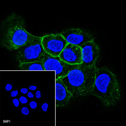CD138 Recombinant Rabbit mAb,PBS Only (SDT-R120)