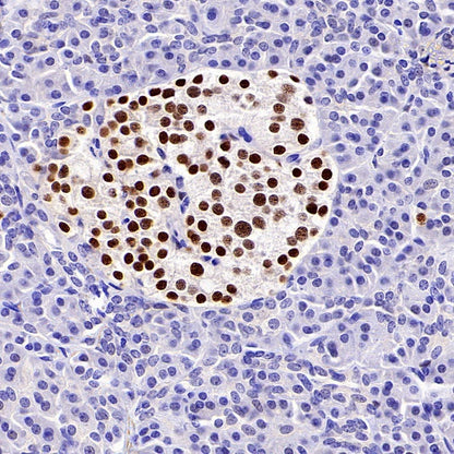 Islet1 Recombinant Rabbit mAb (SDT-2349-17)