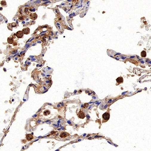 FTH1 Recombinant Rabbit mAb (S-1372-136)