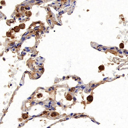 FTH1 Recombinant Rabbit mAb (S-1372-136)