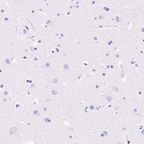 CD42a Recombinant Rabbit mAb (S-2705-46)