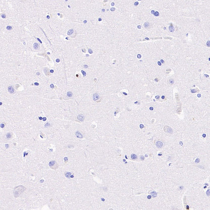 CD42a Recombinant Rabbit mAb (S-2705-46)
