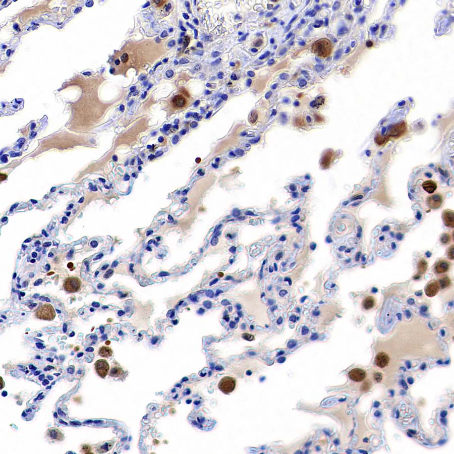 HO-1 Rabbit Polyclonal Antibody