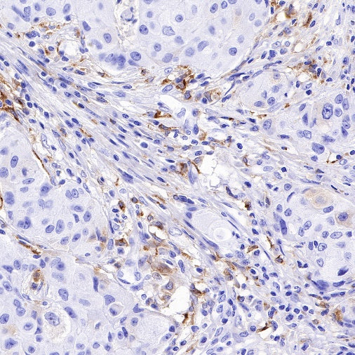 GPNMB Recombinant Rabbit mAb (S-491-6)