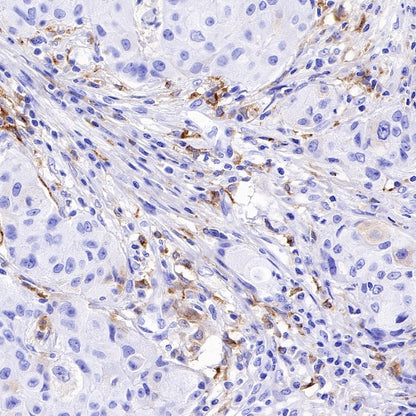 GPNMB Recombinant Rabbit mAb (S-491-6)
