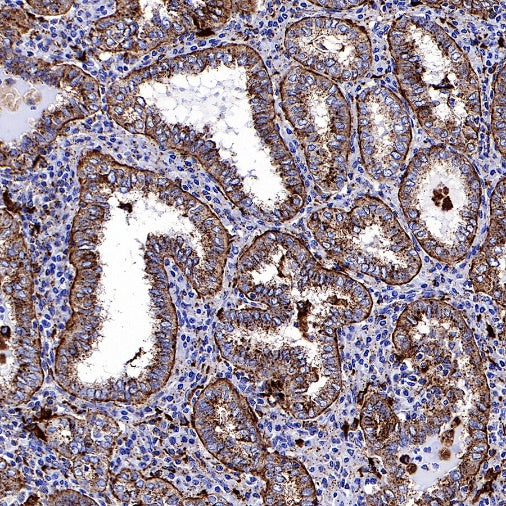 Cathepsin D Recombinant Rabbit mAb (S-R208)