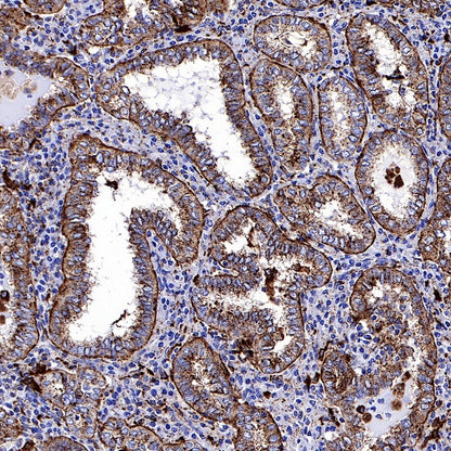 Cathepsin D Recombinant Rabbit mAb (S-R208)