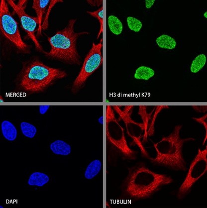 Histone H3 (di methyl K79) Recombinant Rabbit mAb (S-861-22)