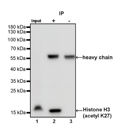 Histone H3 (acetyl K27) Recombinant Rabbit mAb (S-699-50)