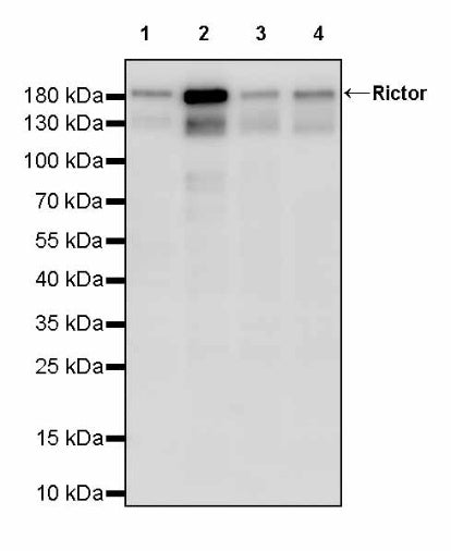 Rictor Recombinant Rabbit mAb (S-2601-26)